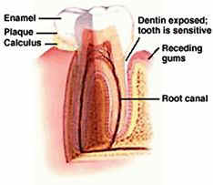 Sensitive Teeth